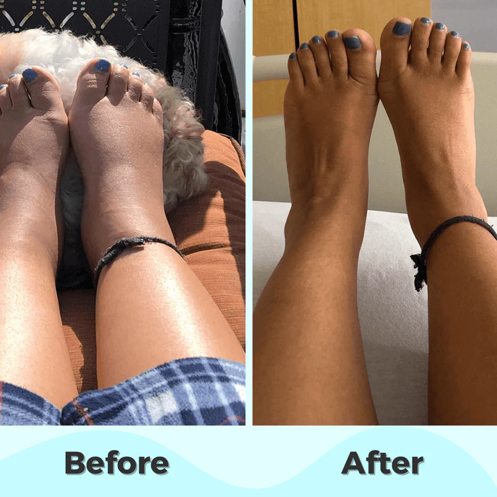 ProFoot™ - EMS Foot Massager